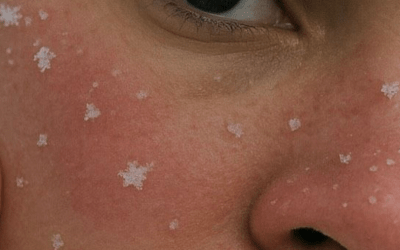 Winter Skin Wellness: Nourish From the Inside Out